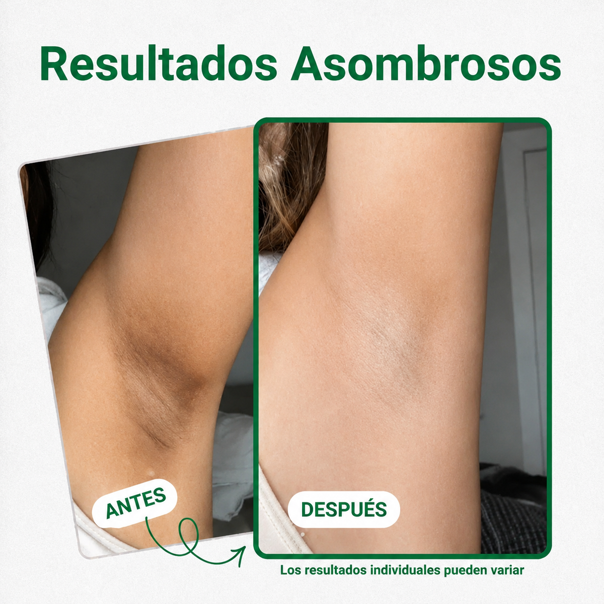Alune™ Parches Despigmentantes y Aclarantes
